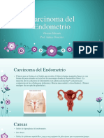 Carcinoma Del Endometrio Presentacionn