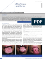 Lymphangioma of the Tongue.pdf