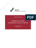 Ecografía de Tiroides - Indicaciones Técnica e Informe