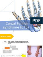 Carpal Tunnel Syndrome (CTS)