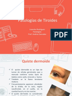 patologias de tiroides