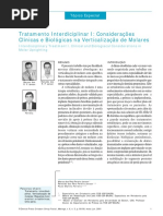 Verticalização de Molares