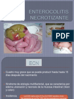 Enterocolitis Necrotizante