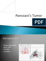 Pancoast S Tumor