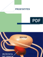 PROSTATITES