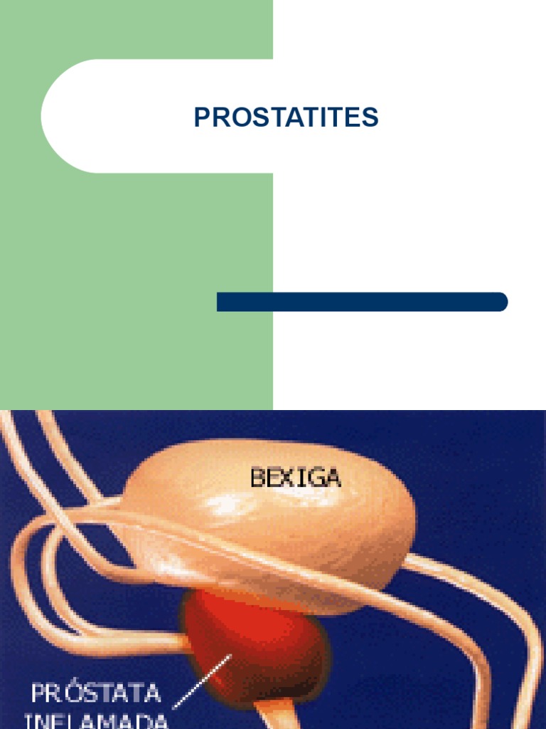Sintomas e Classificação da Prostatite | PDF | Infecção do trato ...