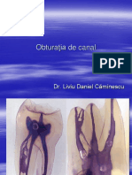 Obturatia de Canal