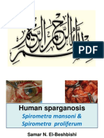 Sparganosis