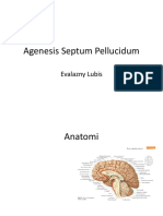 Agenesis Corpus Callosum