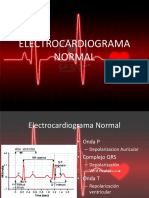 ECG_Normal