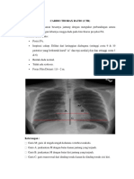 CTR-CARDIO THORAX RATIO