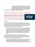 Ventricular Fibrillation