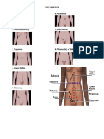 Types of Incision