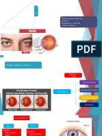 UVEITIS