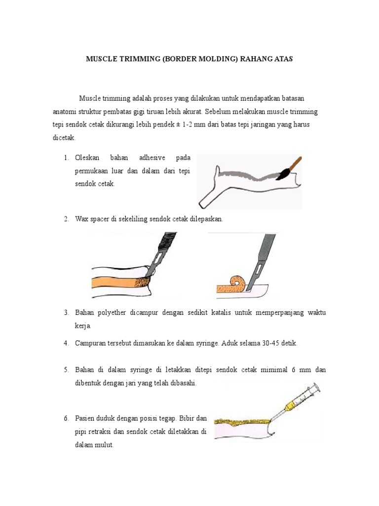Proses Muscle Trimming pada Gigi Tiruan | PDF | Kajian Bahasa Asing ...