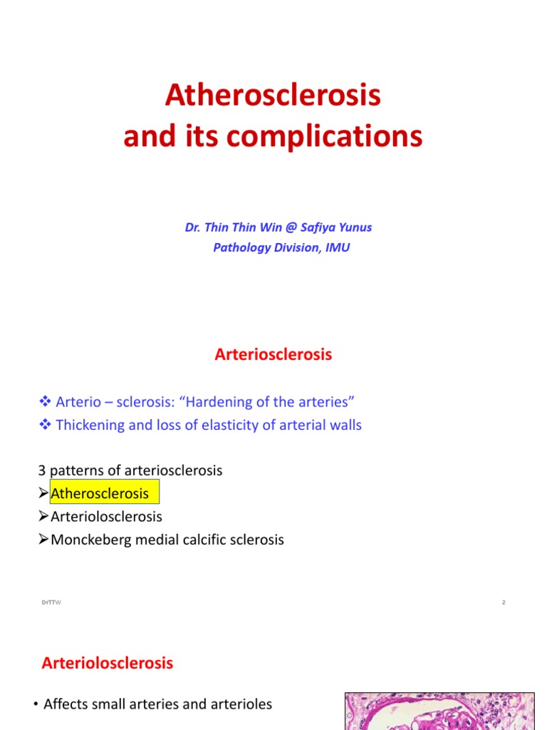 Atherosclerosis: Complications and Risks | PDF | Atheroma | Atherosclerosis
