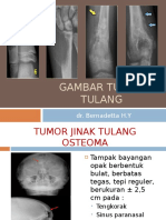 GBR Bimb Tumor Tulang