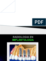 radiografia en implantes.pptx