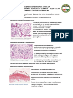 tiposdeinfecciones