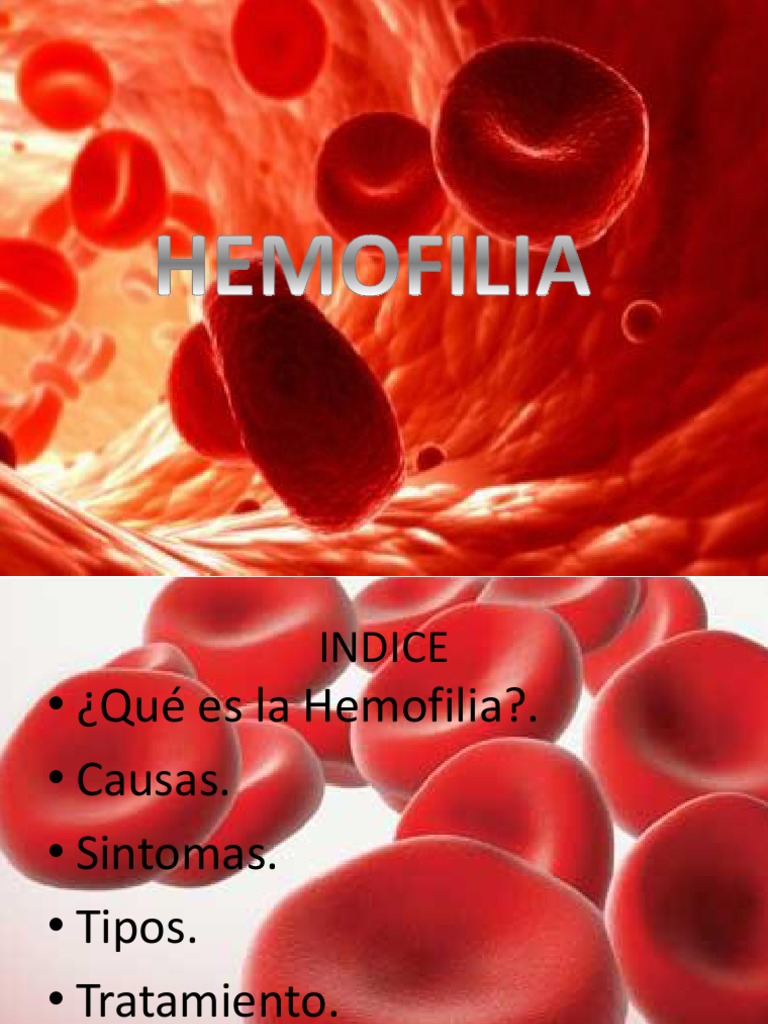 hemofilia.ppt | Hemofilia | Medicina CLINICA