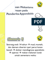 Appendisitis