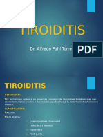 Tiroiditis