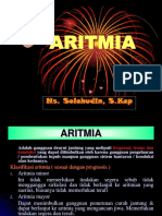 Aritmia Jantung