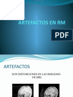 Artefactos en RM