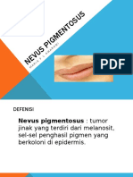 Nevus Pigmentosus