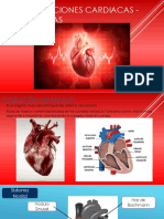 Palpitaciones Cardiacas - Arritmias