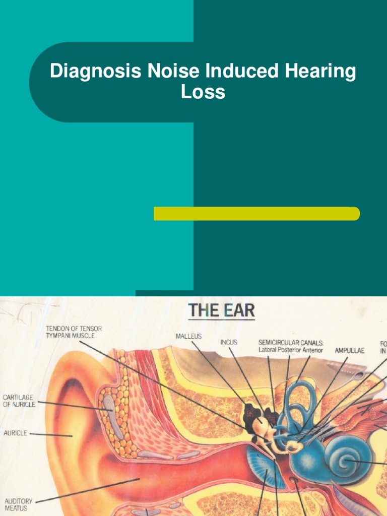 Diagnosis Noise Induced Hearing Loss | PDF