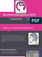 Electroencefalograma