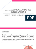 Lesiones Premalignas Del Cuello Uterino