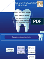 Lesiones Cervicales No Cariosas - Bueno Solano Luis Fernando