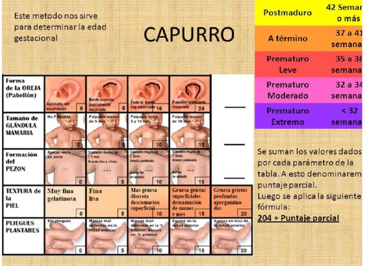 capurro