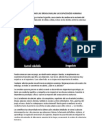 EL CEREBRO ADICTO.docx