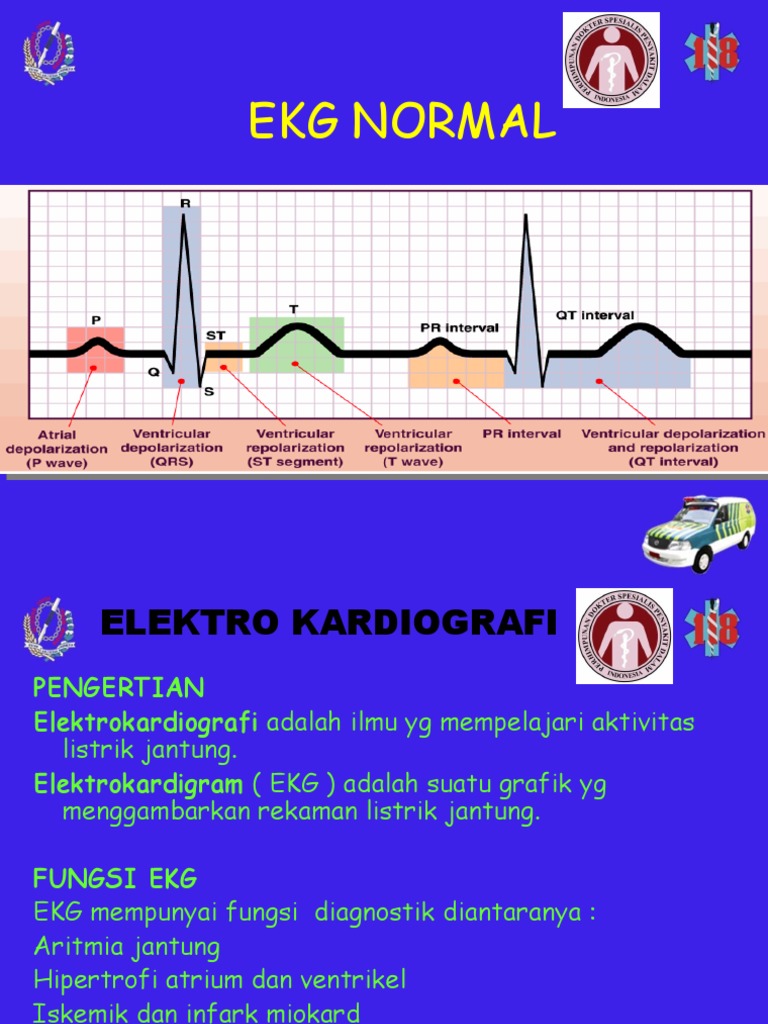 EKG Normal | PDF