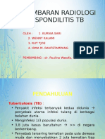 Spondilitis TB