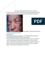 Background: View Media Gallery 13 Common-to-Rare Infant Skin Conditions