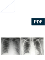 xray arv1