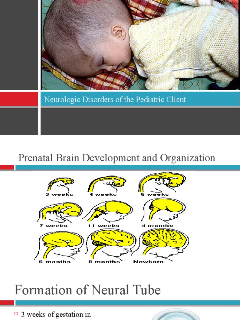 Pediatric Neurologic Disorders Overview | PDF | Human Diseases And ...