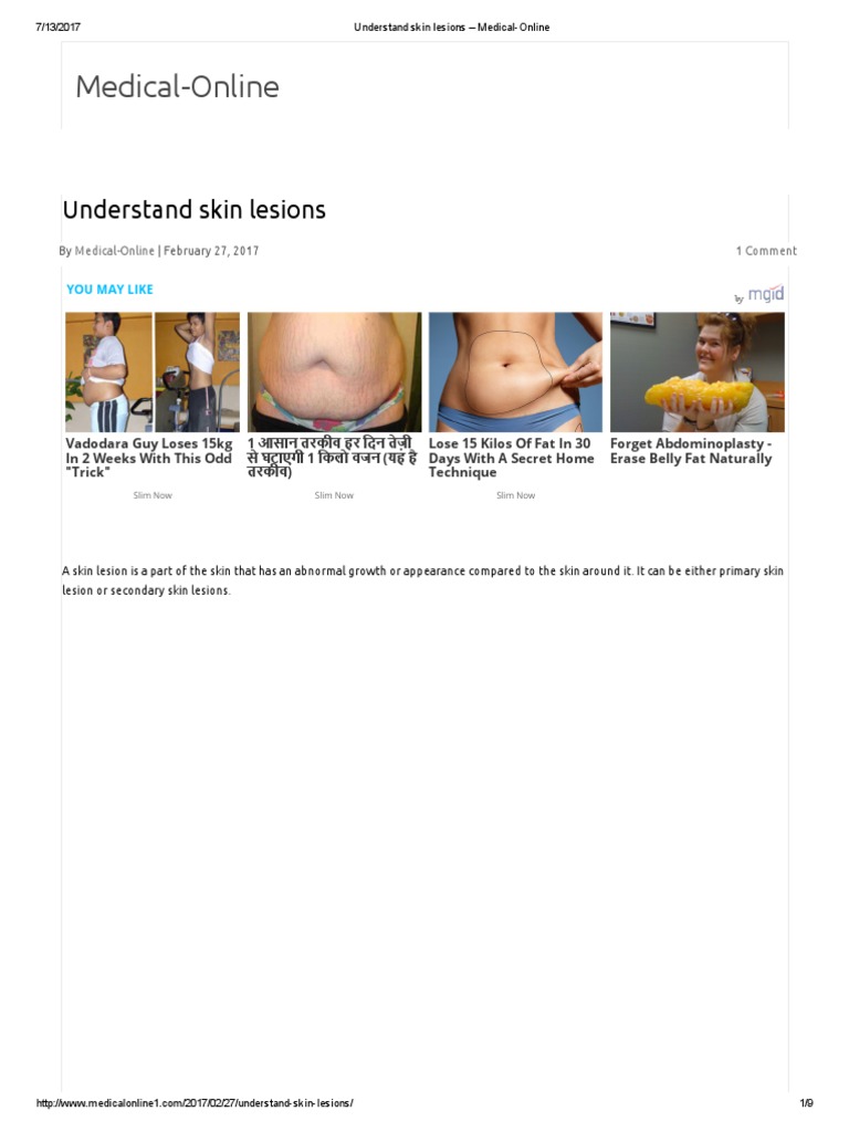 Understand Skin Lesions - Medical-Online | PDF | Cutaneous Conditions ...
