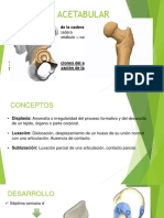 Displasia Acetabular