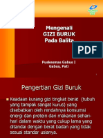 172695687-Gizi-Buruk-Ppt.ppt