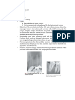 Periodontitis Apikal Akut