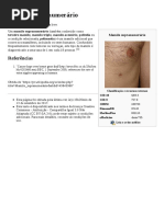 Mamilo_supranumerário