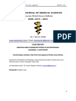 Dental Caries After Radiation On Patient Nashopharingeal Cancer