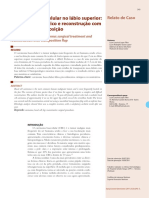 v3 Carcinoma Basocelular No Labio Superior Tratamento Cirurgico e Reconstrucao Com Retalho de Transposicao