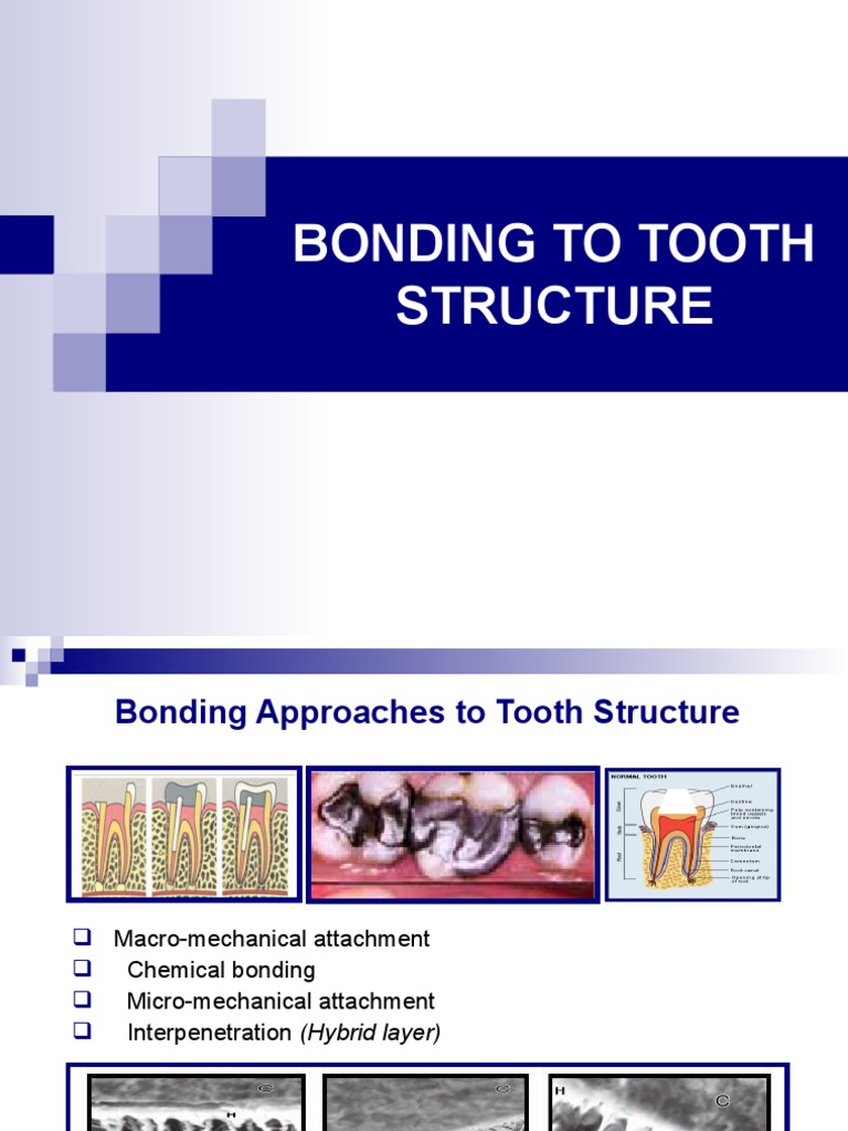 Bonding To Tooth Structure PDF Mouth Chemistry