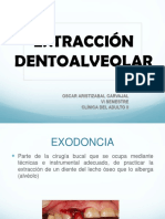 Extraccion Dentoalveolar